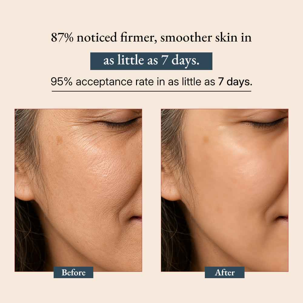 Supercharge Bakuchiol Retinol Serum